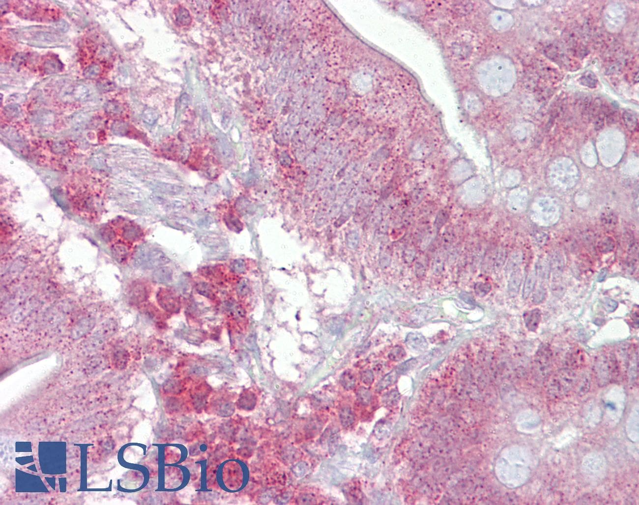 PSEN1 / Presenilin 1 Antibody (aa300-349)