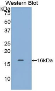 Polyclonal Rabbit anti-Rat Tryptase Antibody (aa29-148, WB)