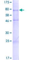 Human UGT1A6 Protein (Recombinant GST)
