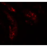 UHRF1BP1L / KIAA0701 Antibody