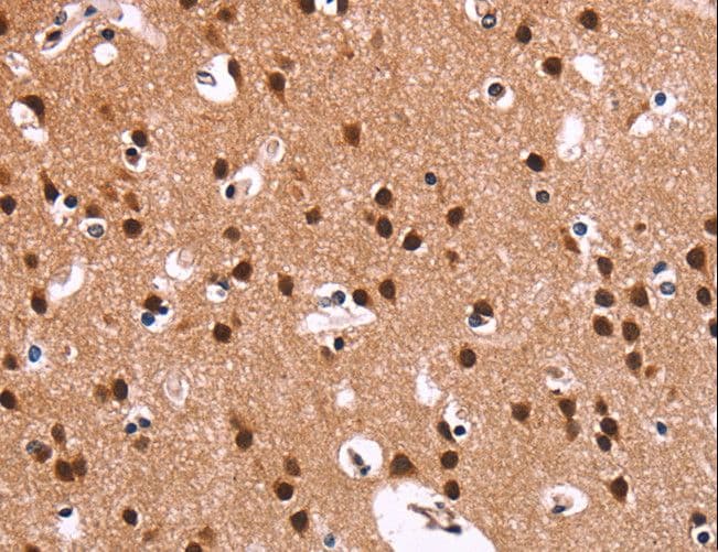 Polyclonal Rabbit anti-Human RPSA / Laminin Receptor Antibody (IHC, WB)