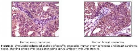 Monoclonal Mouse anti-Human EPHA1 / EPH Receptor A1 Antibody (clone 5D2D1, IHC, WB)