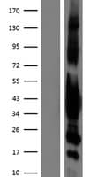 GNAI1 / Gi Protein (Over-Expression Lysate Myc-DDK (Flag))