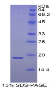 Human HSPB3 Protein (Recombinant His)