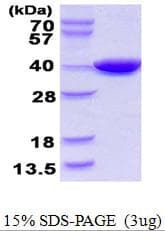 E. coli coaA / Pantothenate kinase Protein (Recombinant His)
