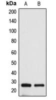 Polyclonal Rabbit anti-Human BAK1 / BAK Antibody (N-Terminus, IHC, WB)