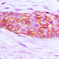 Polyclonal Rabbit anti-Human EDNRA / Endothelin A Receptor Antibody (C-Terminus, IHC, WB)