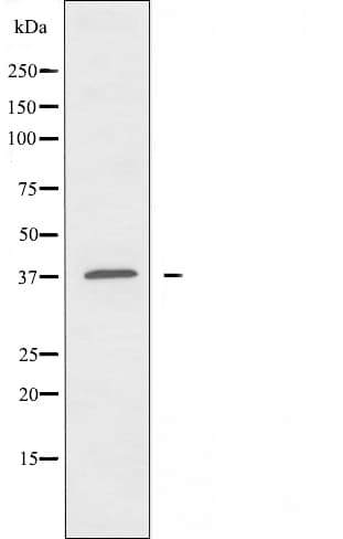 Polyclonal Rabbit anti-Human ATP6AP2 / Renin Receptor Antibody (IHC, IF, WB)