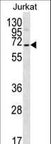 PSAPL1 Antibody (aa130-158)