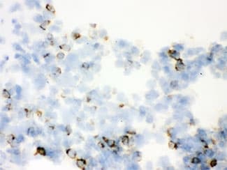 Polyclonal Rabbit anti-Human SFTPA1 + SFTPA2 Antibody (IHC, WB)