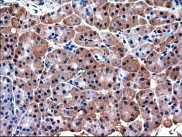 PDX1 Antibody (clone OTI2A12)