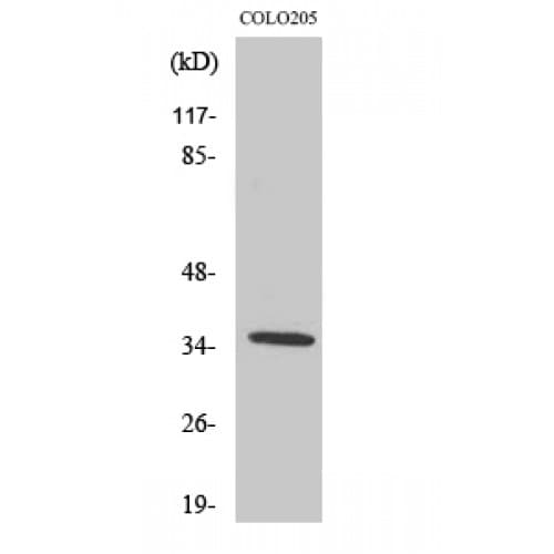 OR52D1 Antibody (240-320 aa, C-terminal)