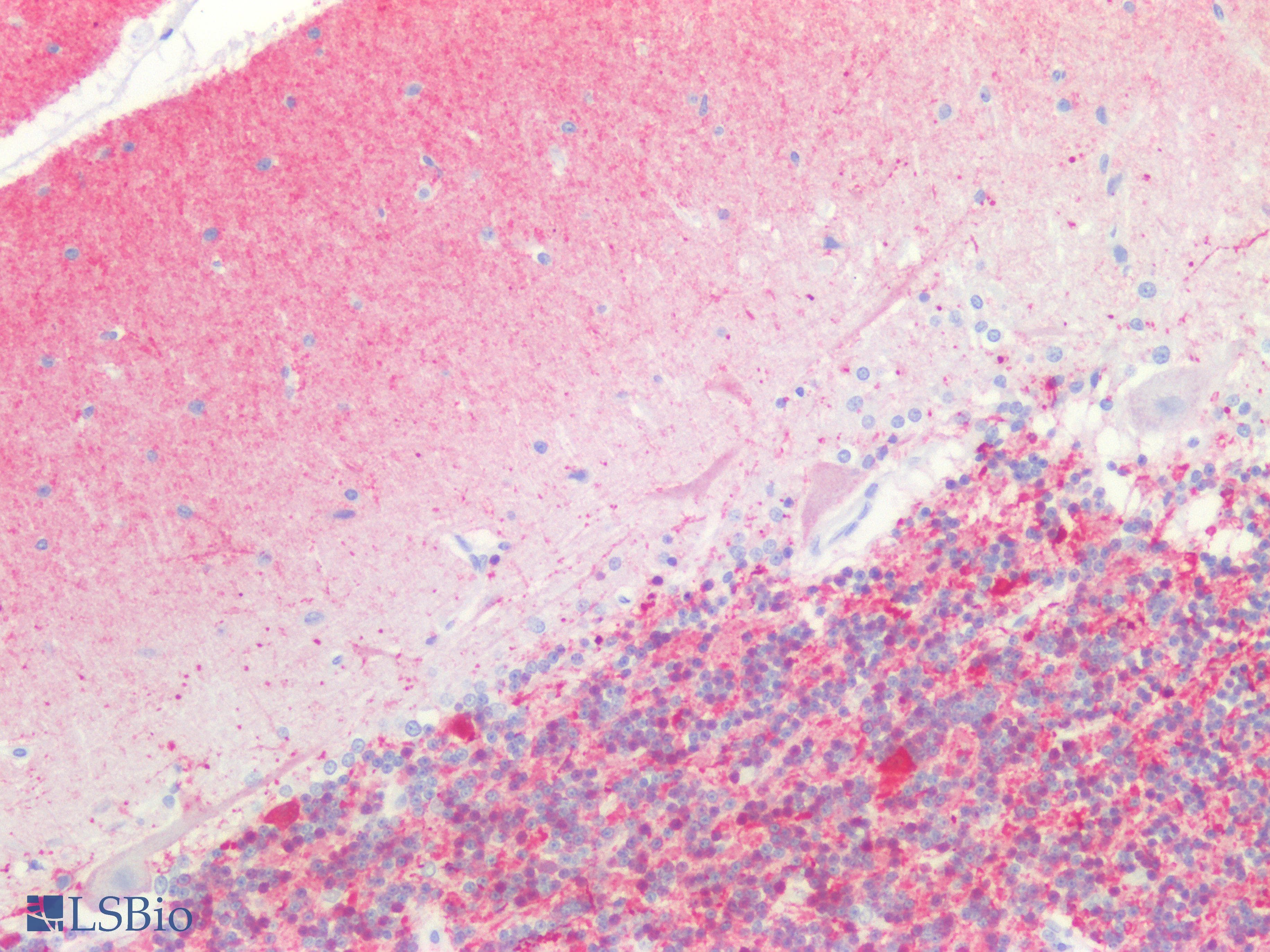 PathPlus™ CALB2 / Calretinin Antibody