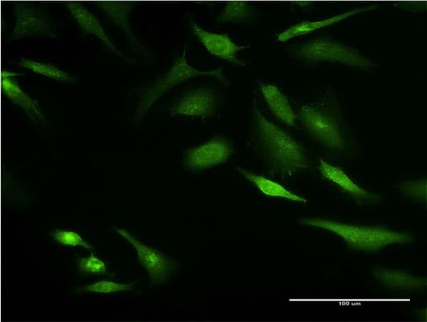 KRT8 / CK8 / Cytokeratin 8 Antibody (clone 3E3)