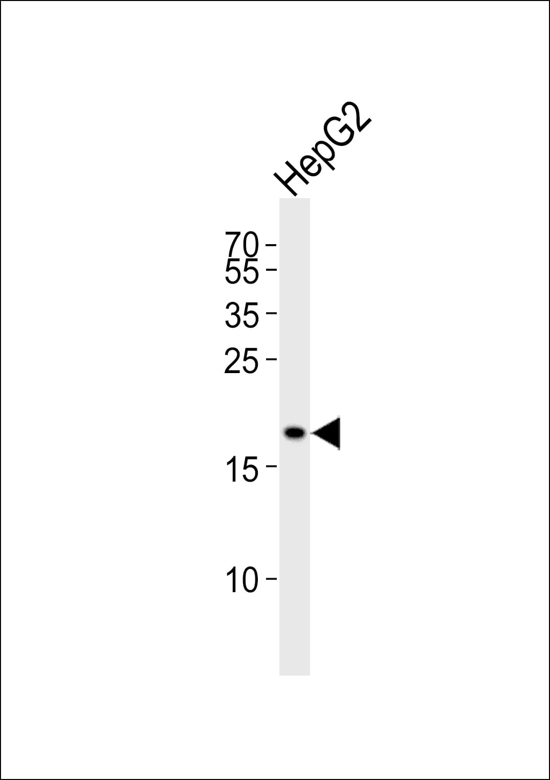PPIF / Cyclophilin F Antibody (aa183-217)