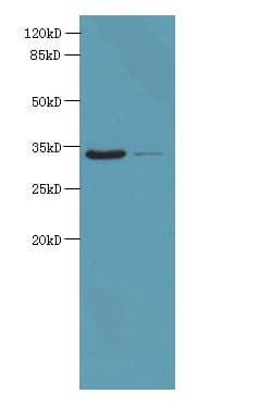 ROGDI Antibody