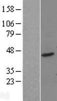 PTOV1 Protein (Over-Expression Lysate Myc-DDK (Flag))