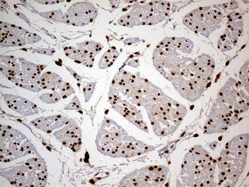 MEIS1 Antibody (aa176-390, clone OTI3H2, Carrier-free)
