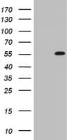 TIPIN Antibody (clone OTI2E2)