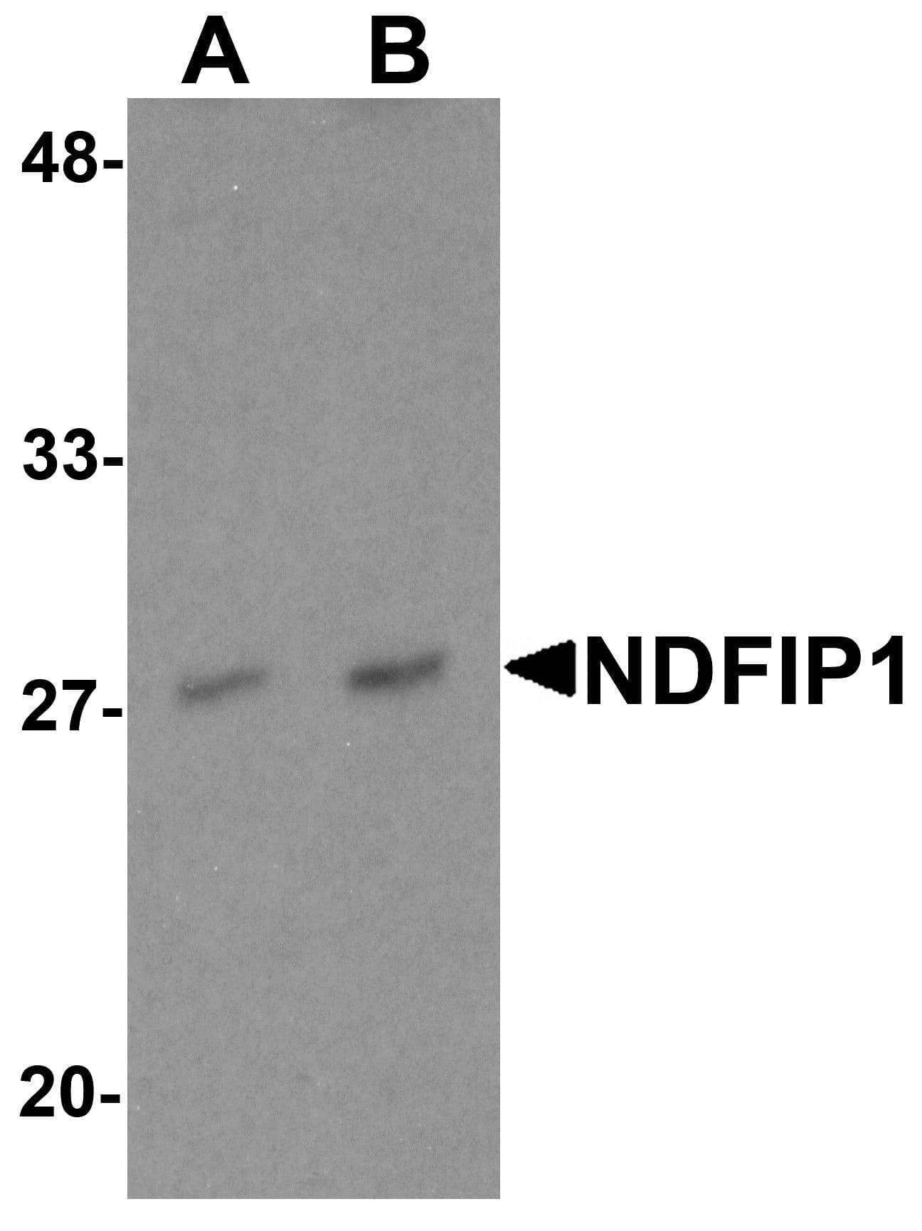 IHC-plus™ NDFIP1 / N4WBP5 Antibody