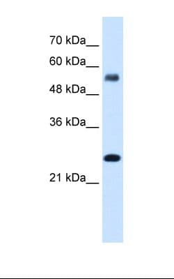 Polyclonal Rabbit anti-Human SMAD1 Antibody (N-Terminus, IHC, WB)