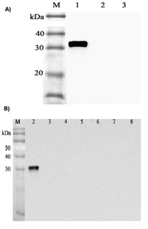 ANGPTL4 Antibody (clone Kairos-1)