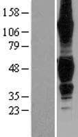 TNFRSF19 / TROY Protein (Over-Expression Lysate Myc-DDK (Flag))