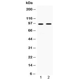 CD119 / IFNGR1 Antibody