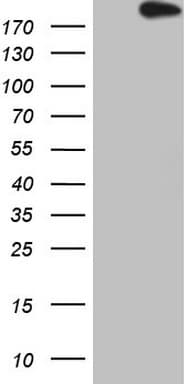 APOBR / APOB48R Antibody (aa780-1088, clone OTI6A6)