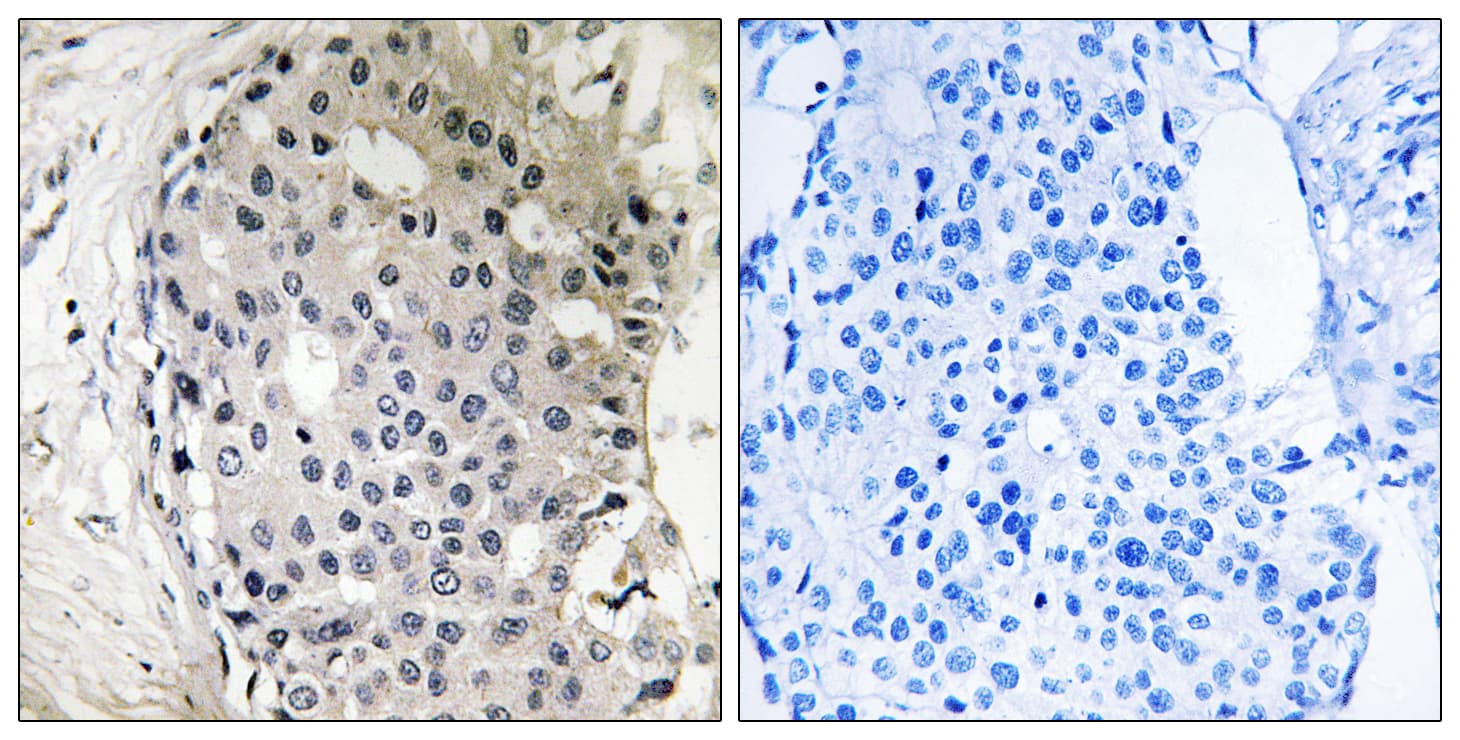 Polyclonal Rabbit anti-Human ARHGEF10 / GEF10 Antibody (aa339-388, IHC, WB)
