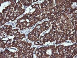 ACAA2 Antibody (clone OTI1B1)