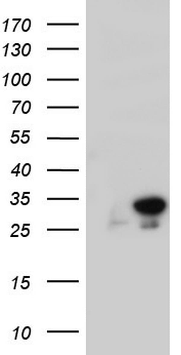 C14orf166 Antibody (clone OTI4B1)