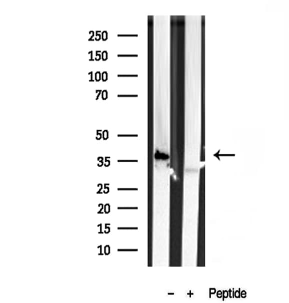 PRKCDBP / CAVIN3 Antibody
