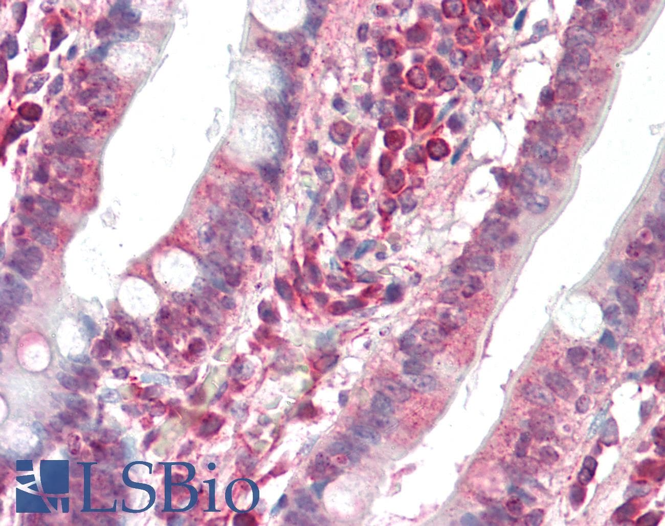 DAPK1 / DAP Kinase Antibody (N-Terminus)