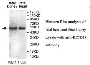 KCTD18 Antibody (aa90-287)