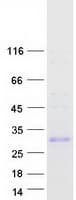 Human UPK2 / UPII / Uroplakin 2 Protein (Recombinant Myc-DDK (Flag))