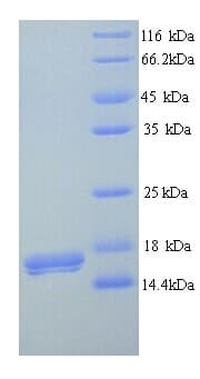 Human CD300LB Protein (Recombinant His)