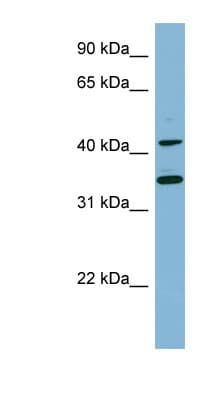 BLNK Antibody (C-Terminus)