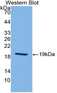 SHH / Sonic Hedgehog Antibody (aa28-192)