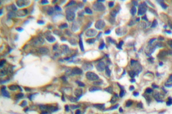 PRKAA1 / AMPK Alpha 1 Antibody (Asp168)