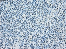 SORD / Sorbitol Dehydrogenase Antibody (clone OTI12A7)