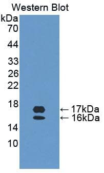 CCL28 / MEC Antibody (aa20-115)