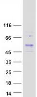 Human NSMCE4A / NSE4A Protein (Recombinant Myc-DDK (Flag))