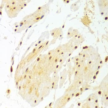 Polyclonal Rabbit anti-Human DKC1 / Dyskerin Antibody (IHC, IF, WB)