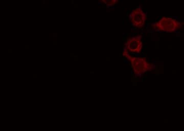 Polyclonal Rabbit anti-Human ATP6AP2 / Renin Receptor Antibody (IHC, IF, WB)