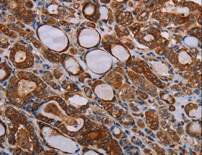 Polyclonal Rabbit anti-Human FABP3 / H-FABP Antibody (IHC)