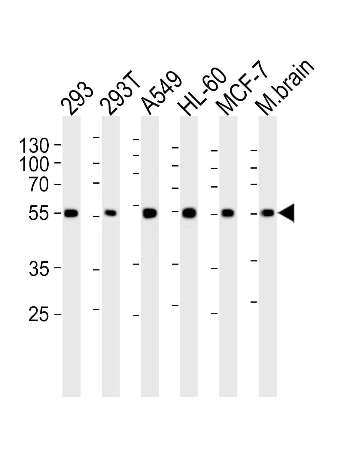 Polyclonal Rabbit anti-Human DKK3 Antibody (aa15-45, IHC, WB)