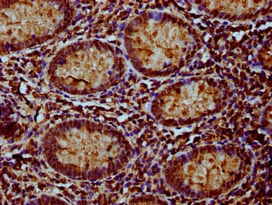 NDUFAF3 Antibody
