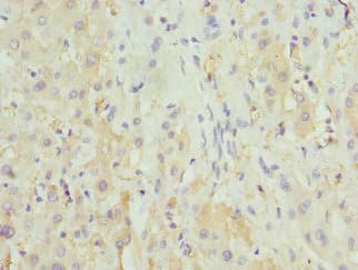 Polyclonal Rabbit anti-Human HGD Antibody (IHC, IF)