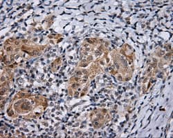 LIPG / Endothelial Lipase Antibody (clone OTI2A5)